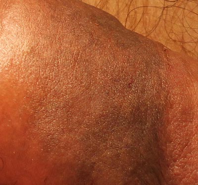 Penile Enlargement Portrait Gallery: CANADA Loria Medical Male Enhancement Image