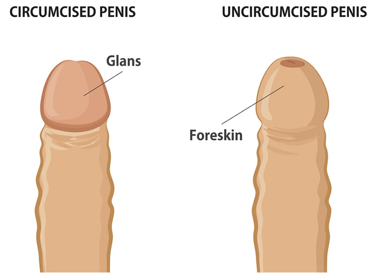 Circumcision Diagram