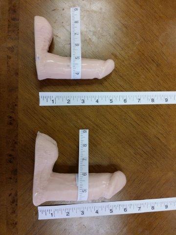 Penis Enlargement Surgery