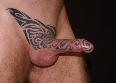 Penile Erect size before treatment image 6