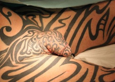 Penile Flaccid size before treatment image 4